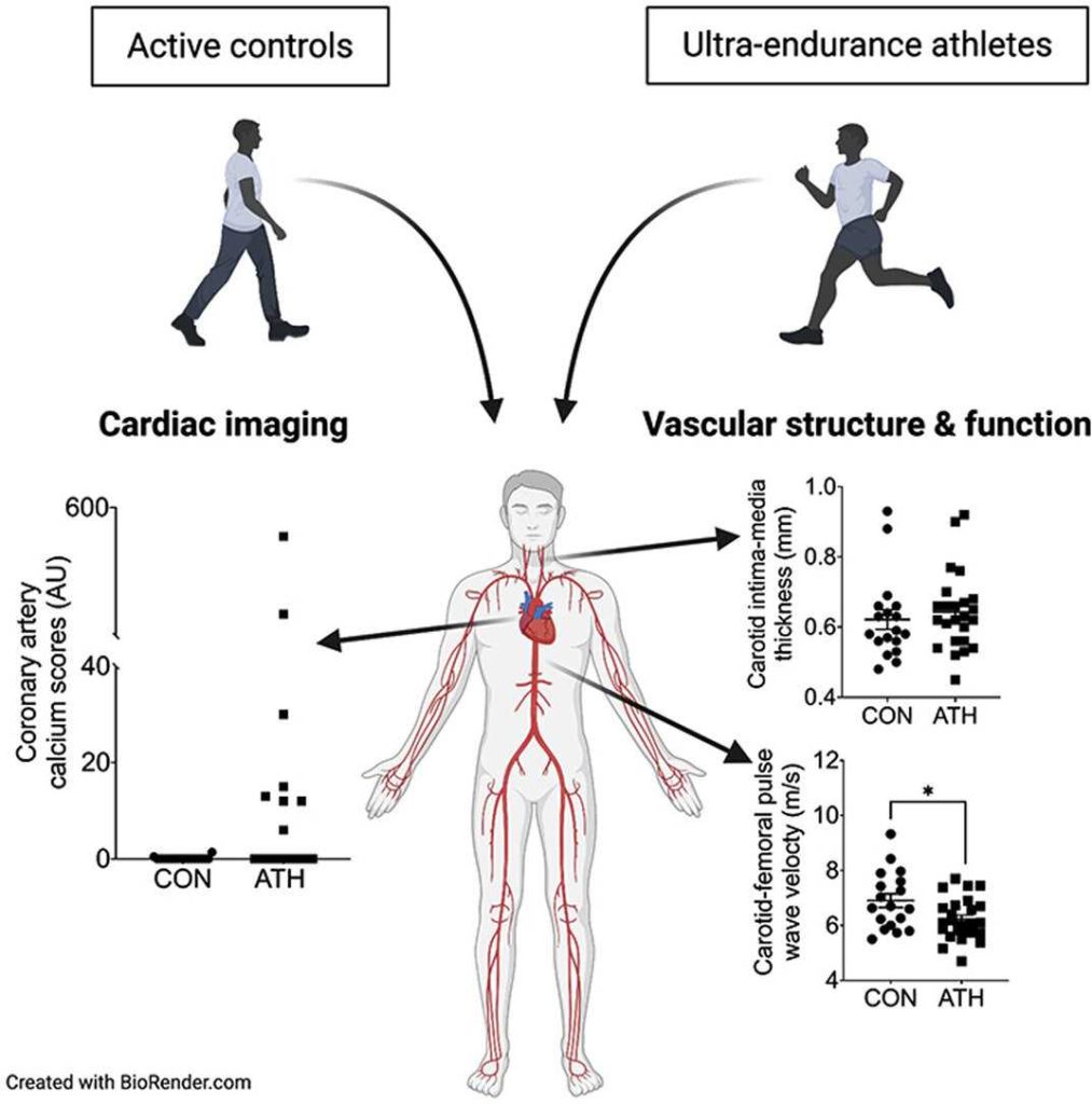 Why Cardio Is Bad For Your Fitness Progress