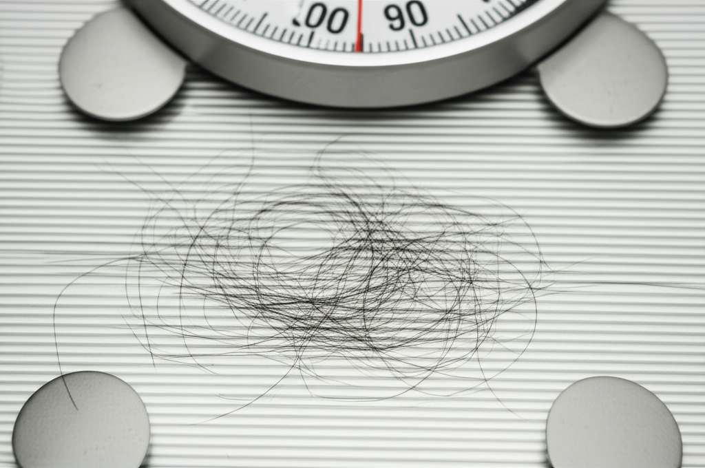 Generate a high-quality, relevant image prompt for an article about: Does Weight Gain Cause Hair Los