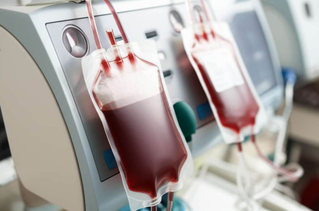 Generate a high-quality, relevant image prompt for an article about: Can Donating Plasma Cause Weigh